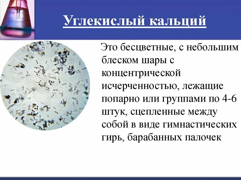 Соли углекислого кальция в моче. Карбонат кальция в моче микроскопия. Кальция карбонат соли в моче. Углекислая известь в моче. Кристаллы кальция в моче у мужчин