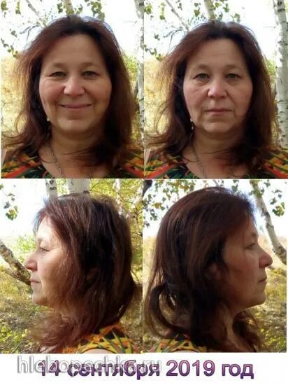 Бурдюг разоблачение до и после пластики. Бурдюг анастасия юрьевна.