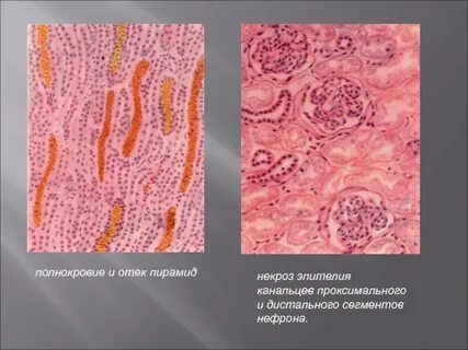 Микропрепарат канальцы почек