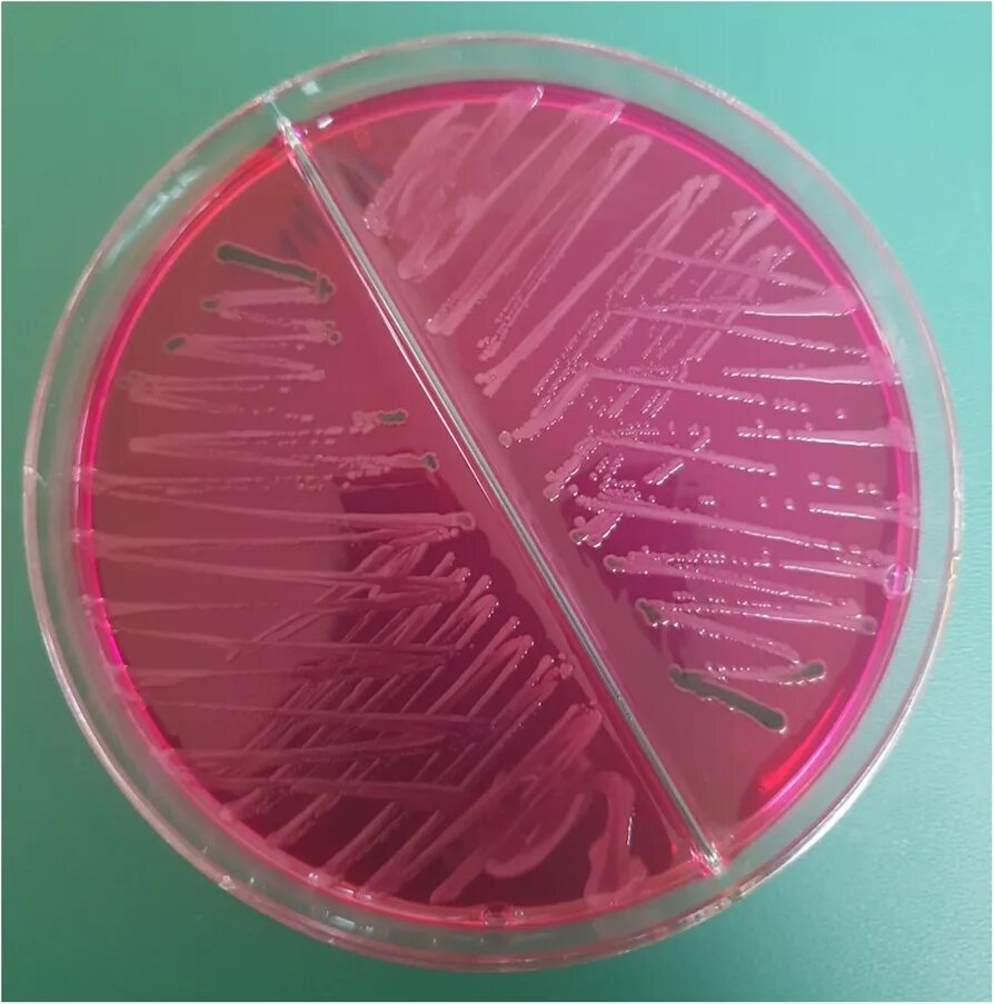 Spp salmonella spp shigella spp. Сальмонелла на xld агаре. salmonella typhi микробиология.
