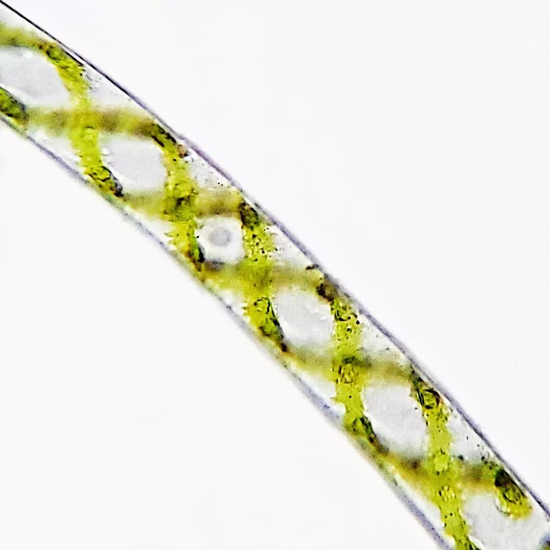 Нитчатые водоросли спирогира. Spirogyra SP. Спирогира водоросль. Spirogyra elongata.