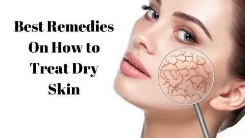 Dry skin
