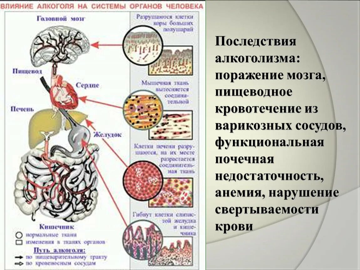 Факторы влияющие на мозг. Влияние алкоголизма на организм человека.