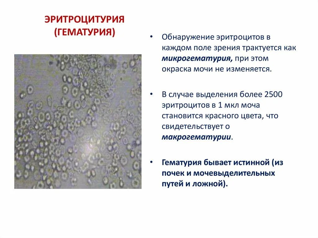 Сколько эритроцитов в моче