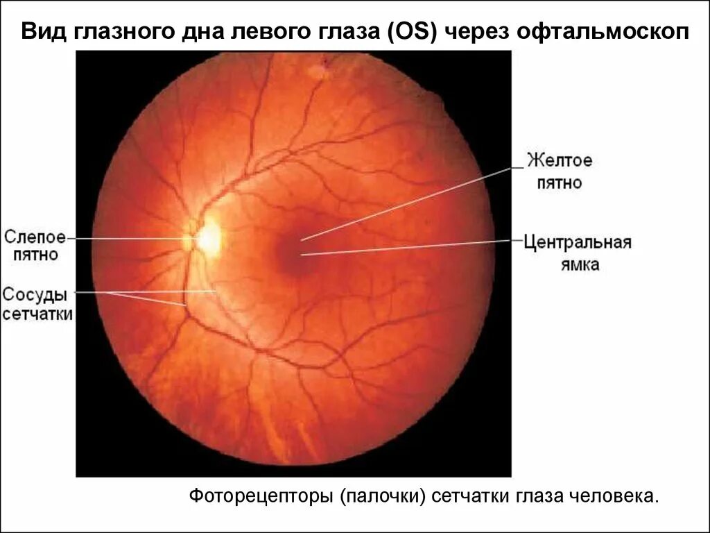 Слепое пятно офтальмология. Желтое и слепое пятно сетчатки глаза. Функция сетчатки глаза желтое пятно. Центральная ямка желтое пятно сетчатки. Диаметр сетчатки