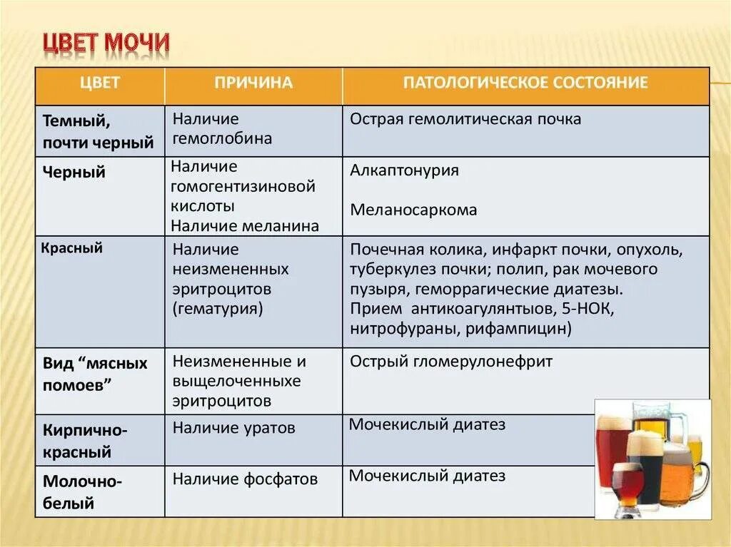 Почему моча изменяется. Изменение цвета мочи причины. Темный цвет мочи. Цвет мочи при болезни. Изменение цвета мочи при патологии.