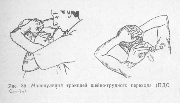 Мануальные манипуляции. Мануальная терапия манипуляции. мануальная терапия схема. манипуляционные техники в мануальной терапии. вправление шейных позвонков.