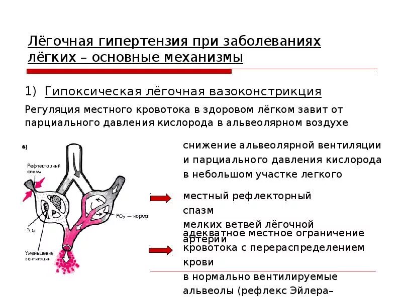 Легочная гипертензия патологическая анатомия. Патогенез легочной артериальной гипертензии. Первичная легочная гипертензия патогенез. Легочная гипертензия и легочное сердце.