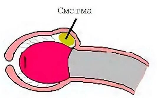 Тип Полового Члена