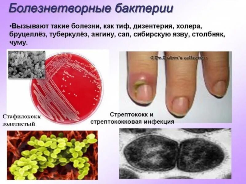 Микроорганизмы вызывающие заболевания называются. Бактерии патогенные 5 класс биология. Патогенные бактерии вызывают заболевание. Болезнетворные бактерии. Болезни вызванные патогенными бактериями.