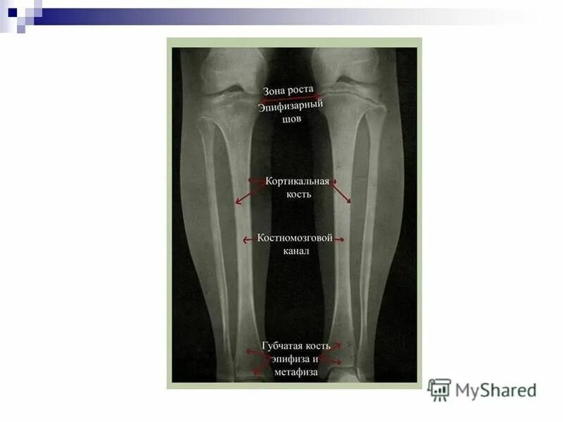 длина зоны роста. корневой чехлик зона роста функции. рост корня 6 класс. эпифизарные хрящи трубчатых костей. клеточное строение корня.