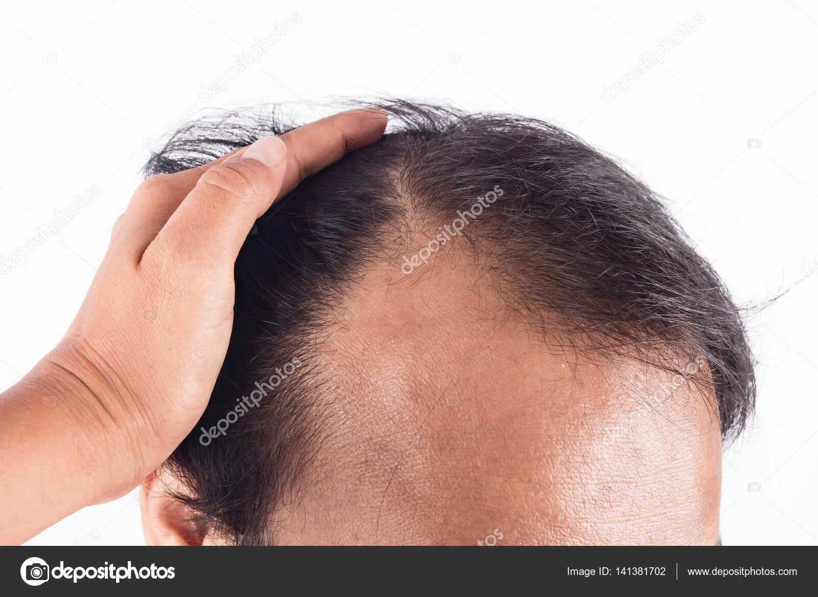 Стрижки на лысеющую голову. Hair loss prevention. Расческа для волос. Hair loss prevention. 100 волос на расческе.