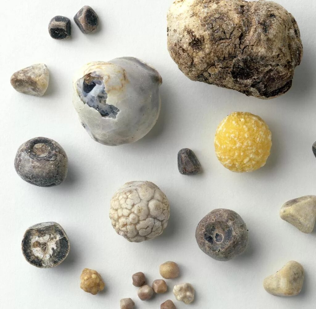 Билирубиновые (пигментные) камни.