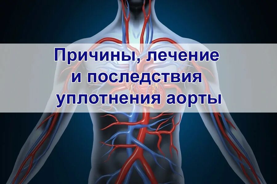 Чем лечить уплотнение аорты сердца. Уплотнение стенок аорты. уплотнение корня аорты.