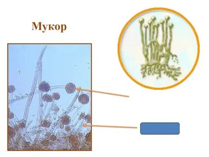 Неклеточная грибница мукора