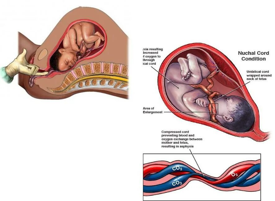 Возможно ли родить с