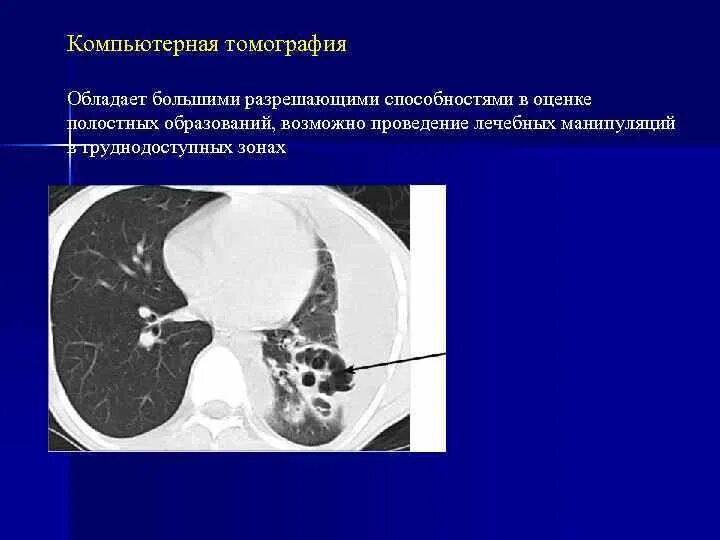Гипостатические изменения кт. Гипостатические изменения кт