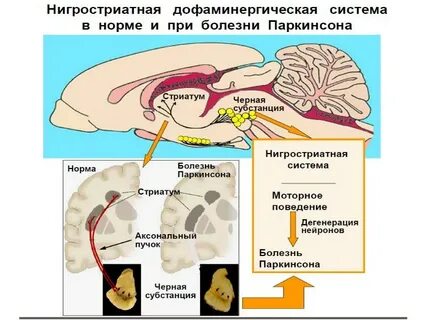 Дофаминергические нейроны