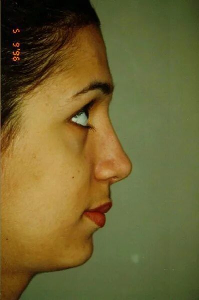 кулиев теймур арифович пластический хирург