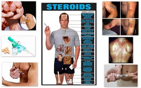 All about Steroids FITNESS FREAK gambar png.