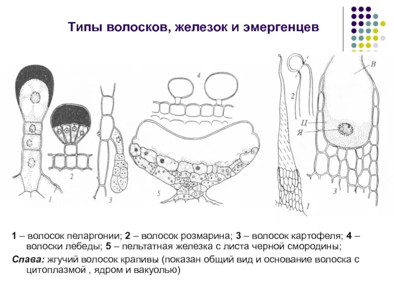 Железистые волоски эпидермы. Железистые волоски растений схема. Железистые волоски эпидермы листа крапивы.