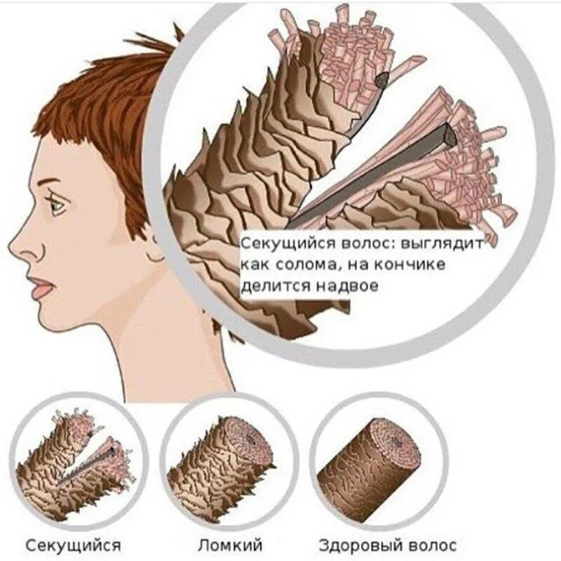 Почему воняет волосы. Секущиеся кончики. Ломкие и секущиеся волосы. Секущие кончики волос. Как выглядят секущиеся волосы.