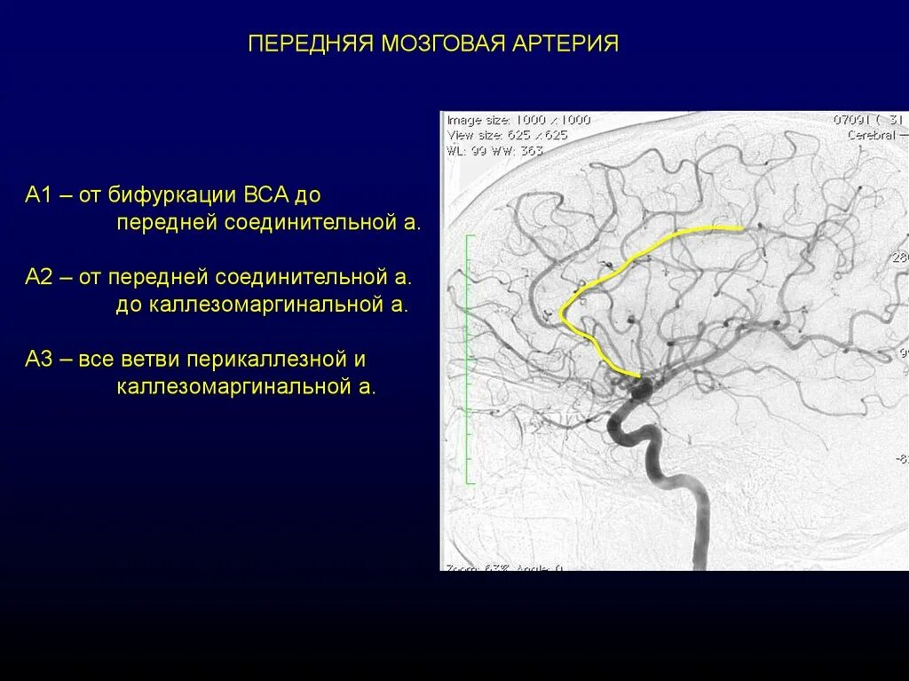 М1 сегмент средней мозговой артерии. Сегменты передней мозговой артерии на кт. Анатомия передней мозговой артерии сегменты. Сегменты передней мозговой артерии схема.