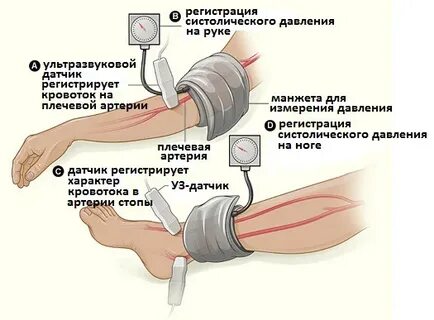 Мерят ли давление на ногах