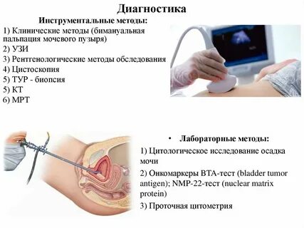 Удаление мочевого пузыря сколько длится операция