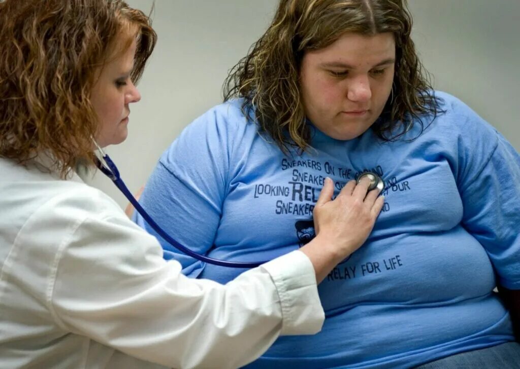 Толстый больной. Ожирение у подростков. Дети с избыточным весом. Лишний вес и ожирение. Ожирение у женщин.