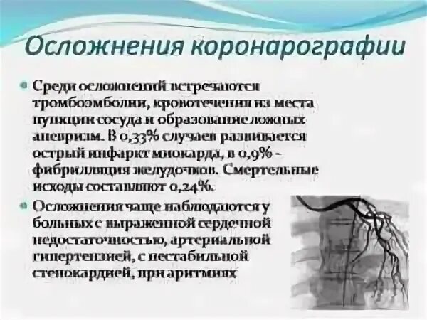 Коронарографии как часто делают
