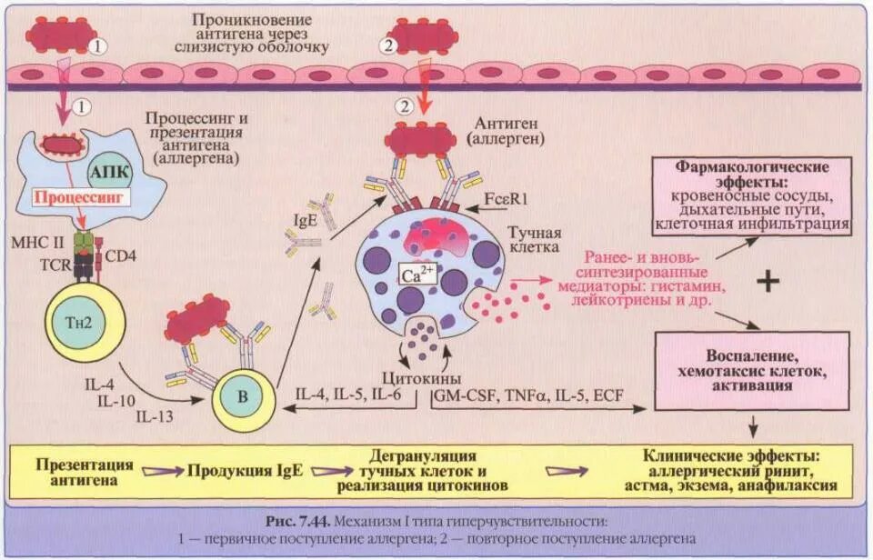Патогенез реакции гиперчувствительности 1 типа. Схема патогенеза реакции гиперчувствительности 1 типа. 3 Тип гиперчувствительности патофизиология. Аллергическая реакция 1 типа. Иммуноглобулин слизистых оболочек
