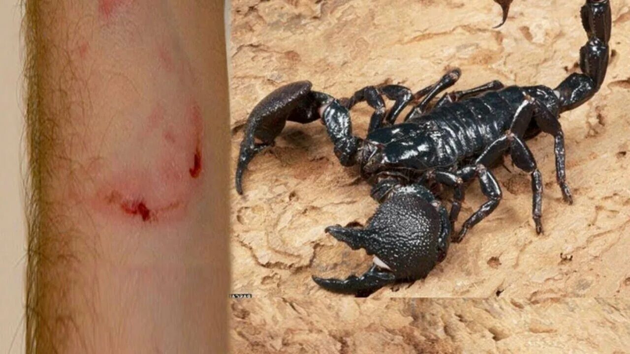 Как жалит скорпион. Новорожденный скорпион. Как жалит скорпион. Как жалит скорпион. Скорпион.