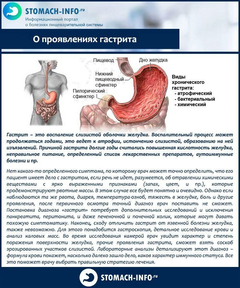 Гастрит, язвенная болезнь, панкреатит. Заболевание пищеварительной системы гастрит.