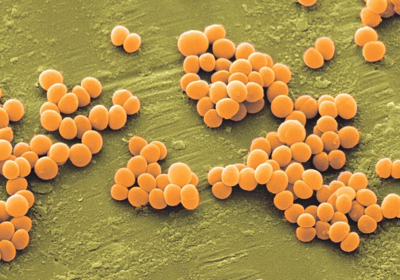 1 staphylococcus aureus