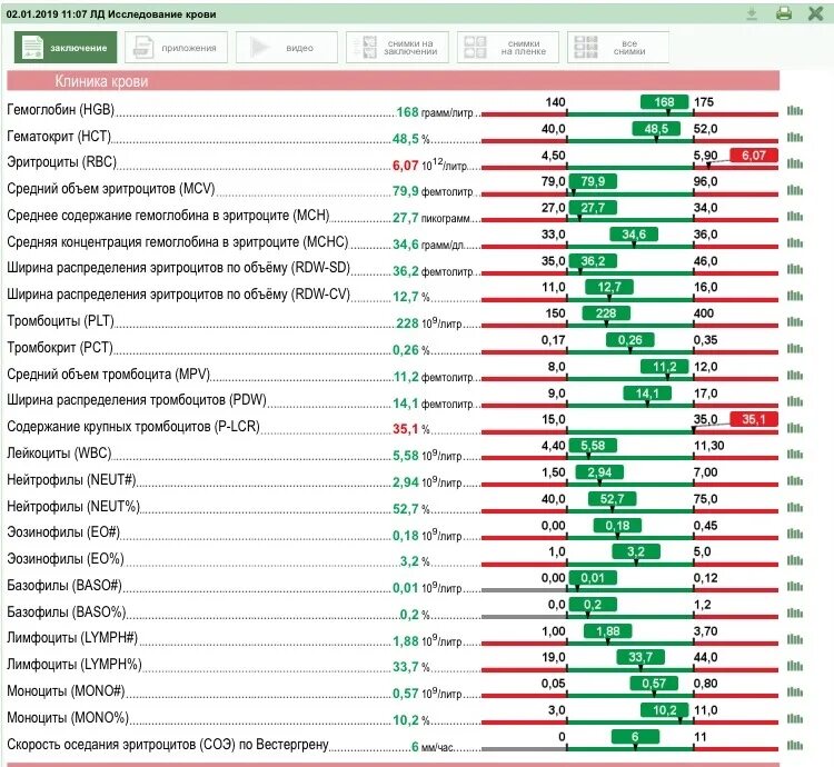 Plcr в анализе крови. P В анализе крови что это. Анализ крови расшифровка p LCR. P-LCR В анализе крови повышен. P-LCR (коэффициент больших тромбоцитов) норма.