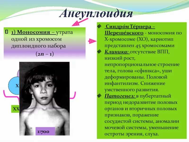 Синдром шерешевского тернера кратко. Синдром шерешевского тернера моносомия по х хромосоме. синдром шерешевского - тернера (моносомия x - хо). моносомия по 1 хромосоме. синдром шерешевского тернера набор хромосом.