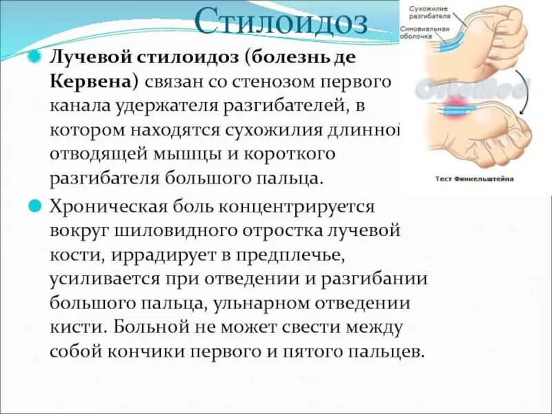 Болезнь суставов де кервена. Де Кервена болезнь запястье. Симптом при болезни де Кервена.