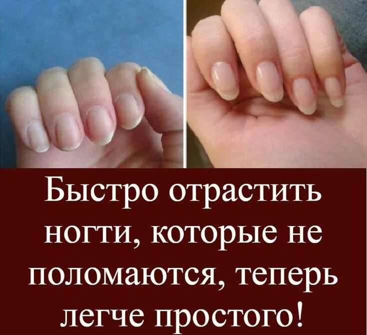 Как быстро ногти. Отрастить ногти. быстро отрастить ногти. как быстрее отрастить ногти.