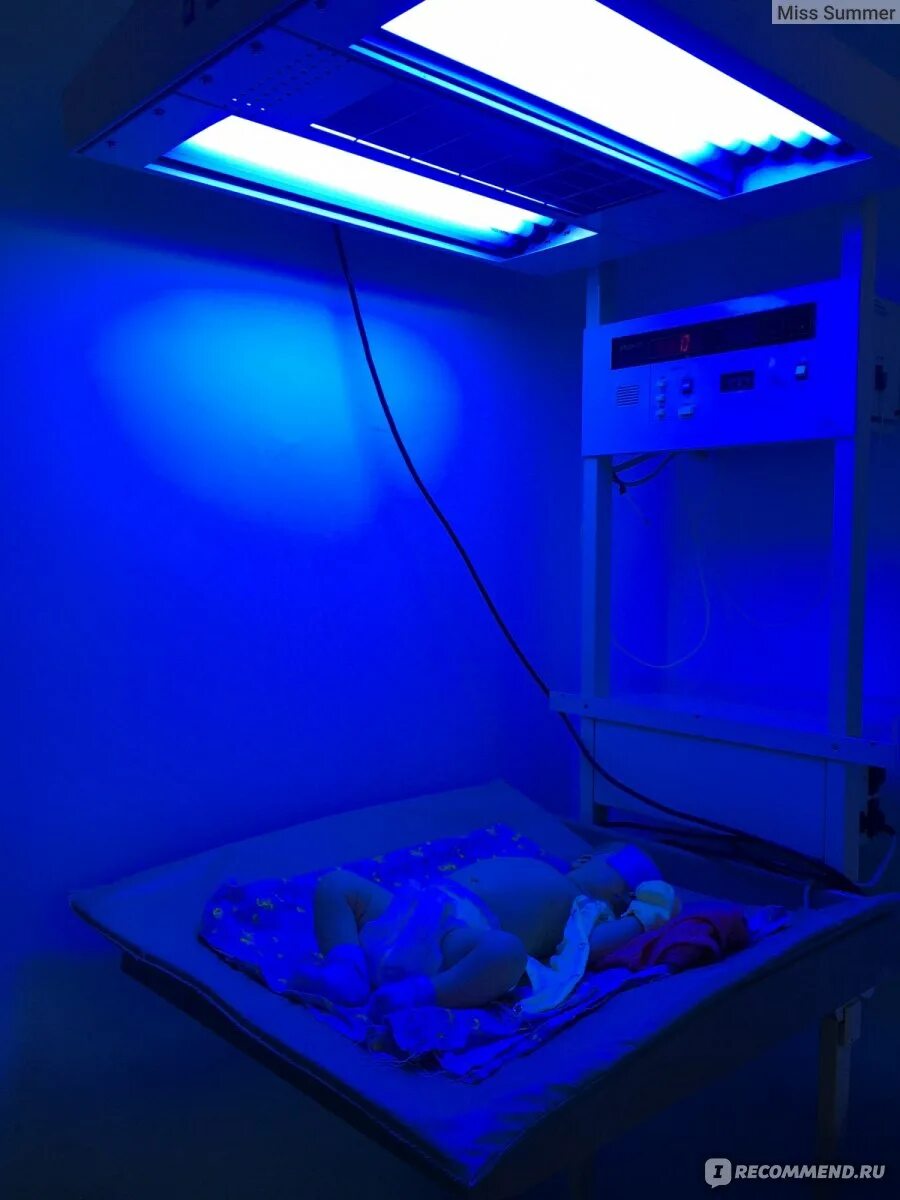 Новорожденный лежит под лампой ультрафиолета. Лампа для фототерапии новорожденных. Синяя лампа от желтухи. Фототерапия для новорожденных при желтухе. Фототерапия для новорожденных при желтухе.