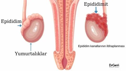 Нұрлаттағы жалаңаш қыздардың суреттері