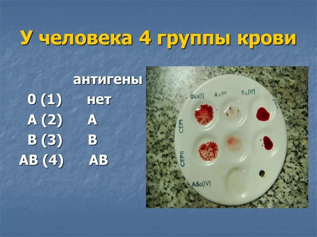 Группа крови. Самая распространенная группа крови. Кровь группы крови. Редкие типы крови. Какая группа крови в россии