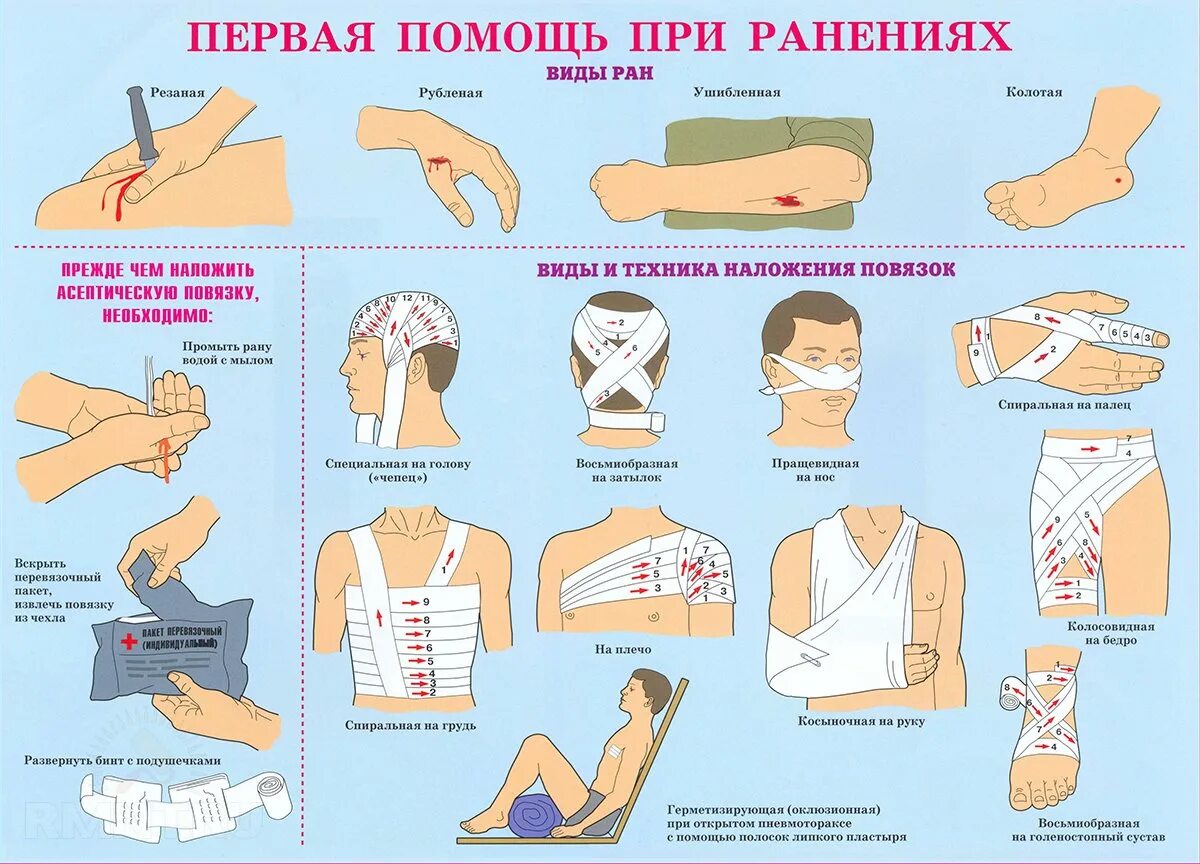 Оказание первой медицинской помощи при осколочных ранениях. Первый этап оказания первой помощи при ранениях. Принципы оказания медицинской помощи при ранениях. Оказание первой помощи при ранениях и кровотечениях.