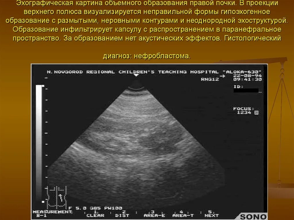 Неоднородное округлое образование