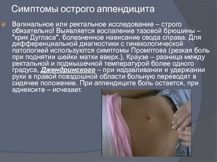 Вуайеризм Мурзик юбка