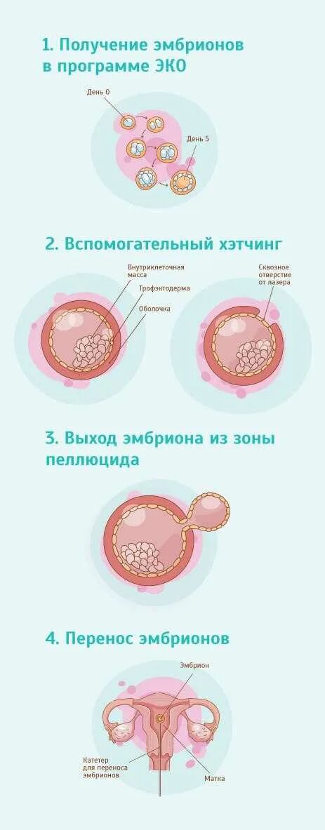 Эмбрион после пересадки. Хетчинг эмбрионов. Эко перенос эмбрионов. Подсаживание эмбриона эко.