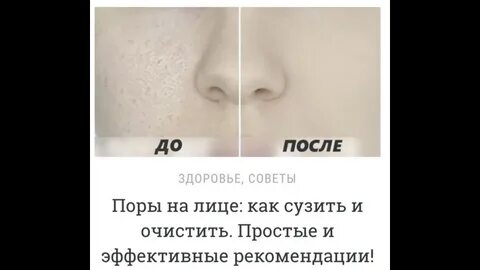 Оне пор