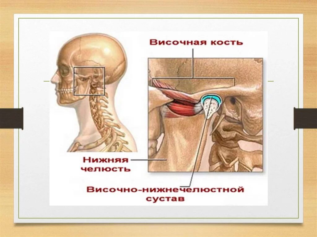 Артрит височно-нижнечелюстного сустава препараты. Артроз височно-нижнечелюстного сустава. Артроз нижнечелюстного сустава. Артроз челюстного сустава. Лицевой артрит