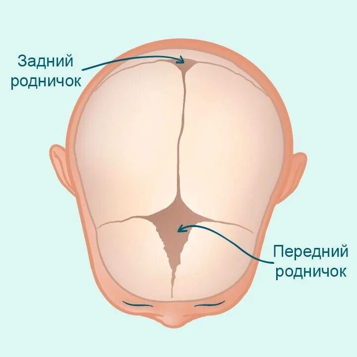 Во сколько зарастает родничок. Малый Родничок у новорожденных расположен. Передний Родничок черепа новорожденного. Большой и малый роднички у новорожденных.