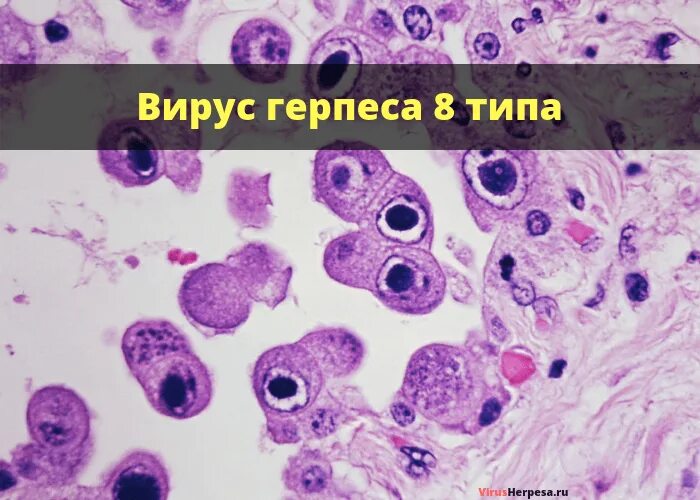 Virus 7. Герпесвирус типы.